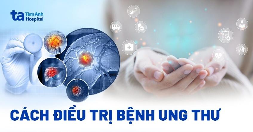 7 cách điều trị bệnh ung thư phổ biến, hiệu quả cao hiện nay