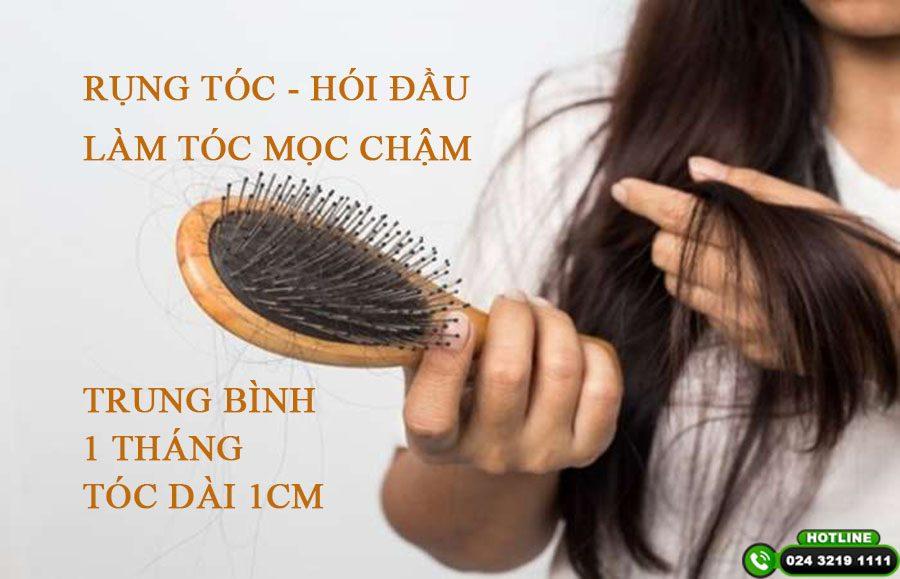 Trung bình 1 tháng tóc dài bao nhiêu cm? Cách kích thích tóc mọc nhanh hơn trong vòng 1 tháng