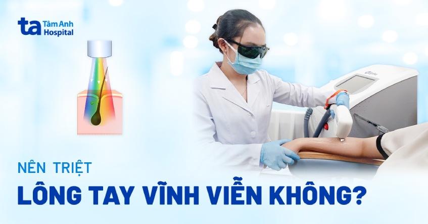 Triệt lông tay vĩnh viễn là gì? 3 cách được bác sĩ tin dùng