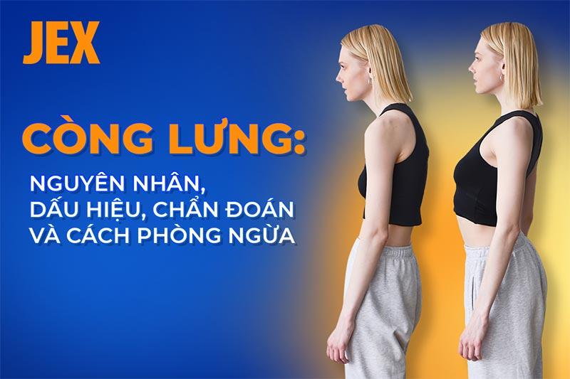 Còng lưng: Nguyên nhân, dấu hiệu, chẩn đoán và cách phòng ngừa